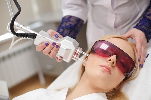 Face laser rejuvenation