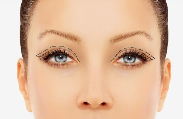 The contour of the eyelids