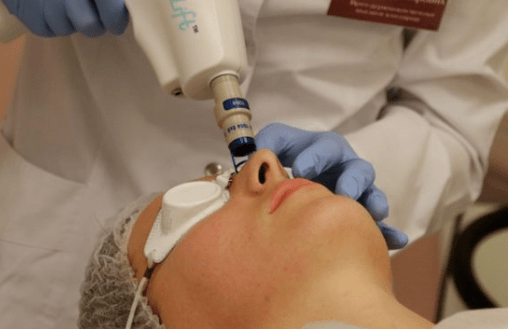 Laser rejuvenation not capable